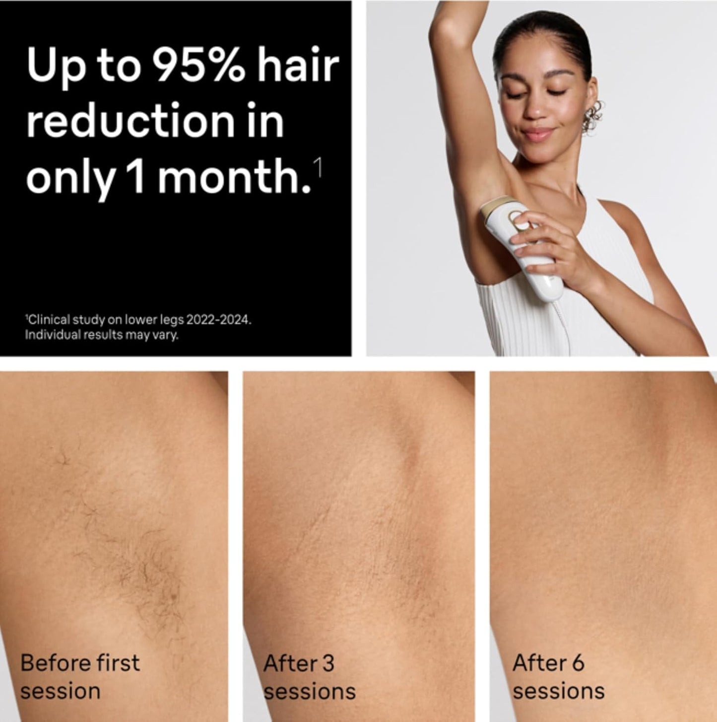 Braun Silk Expert Pro 5 IPL Hair Removal Device - New Condition